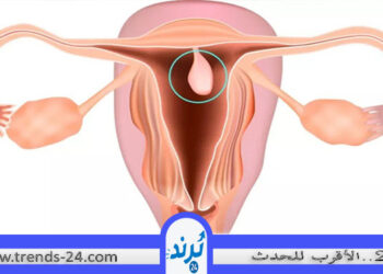 النظام الغذائي الأفضل لــ تجنب مشكلات بطانة الرحم – اعرفيها